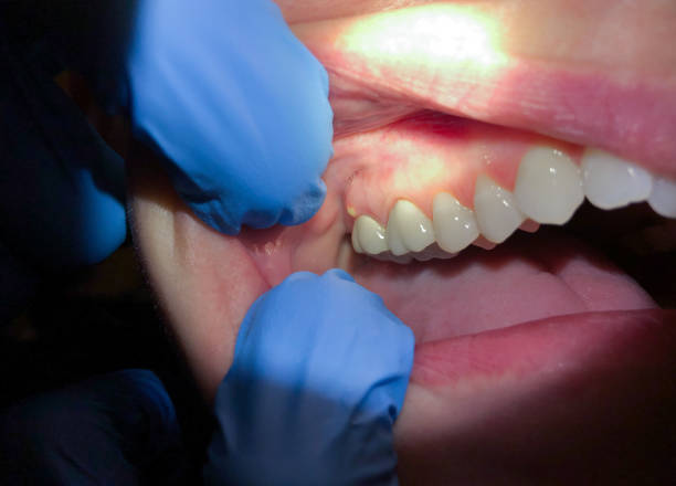 Best Emergency Cosmetic Dentistry in Sam Rayburn, TX