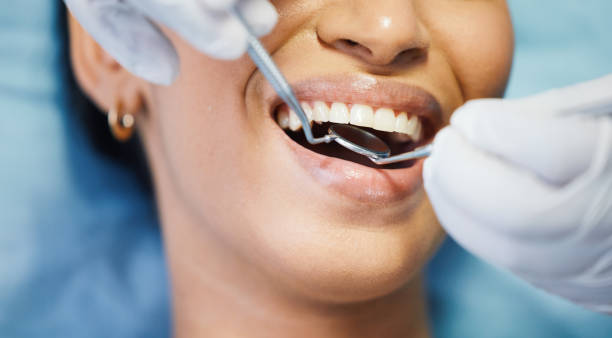 Best Broken or Cracked Tooth Emergency Dentist in Sam Rayburn, TX